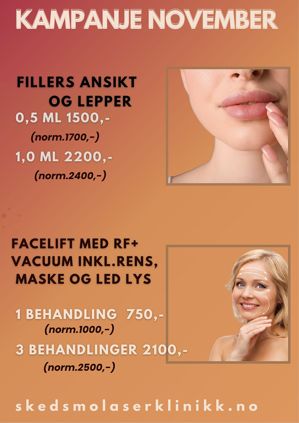 Kampanje november 2025